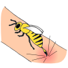Bee Sting Picture