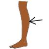 leg Picture