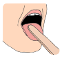 Tongue Depressor Picture