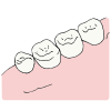 4+teeth Picture