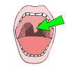 Uvula Picture