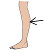 a+leg Picture